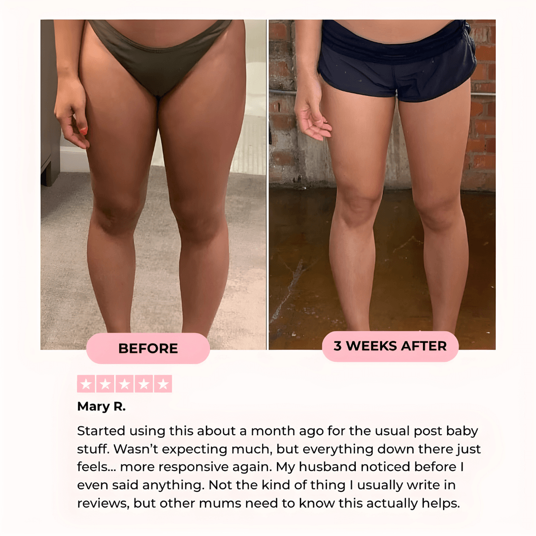 ToneThigh™ Pelvic & Thigh Trainer